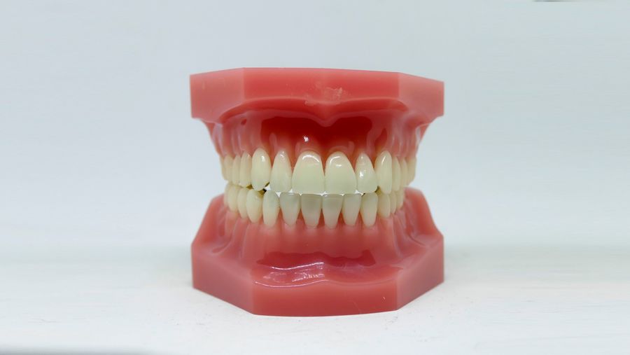 Modelo de arcada dentária, imagem ilustrativa