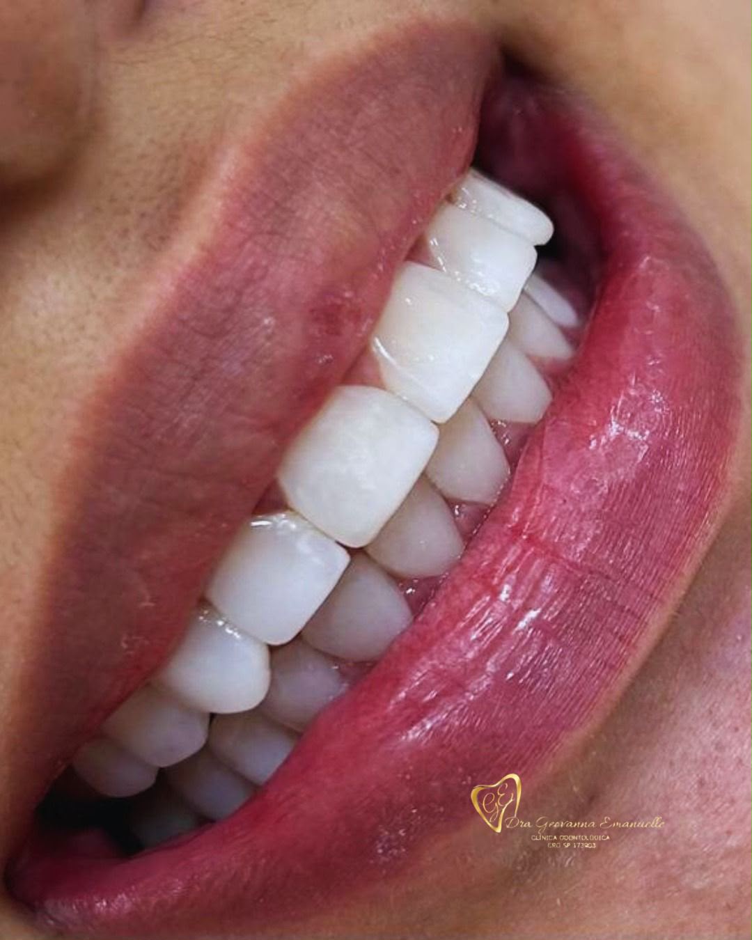 Sorriso com dentes bem cuidados, foto fornecida pela clínica